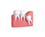 depositphotos_194800846-stock-photo-3d-render-of-teeth-with