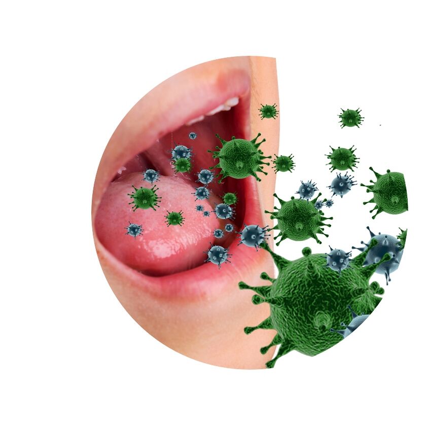 Mund-Bakterien-Gesundheit-Zahnreinigung-MundHygiene