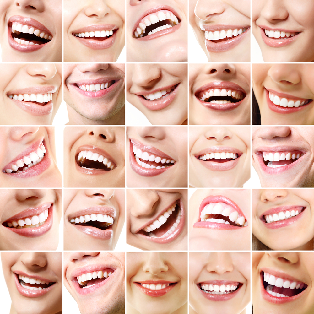 Lachen-Zahn-Mundhygiene-Zahnreinigung-25-Gesichter-Menschen