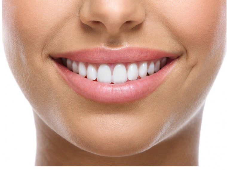 Weisse-Zähne-Lachen-Mundhygiene-Zahnreinigung-Frau