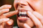 Frau mit Bleichstreifen oder Whitestrips. Zähne zu Hause aufhe