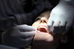 Parodontitis-Zahnreinigung-Behandlung-Mundhygiene-Frau-Zahnarzt-parodontosebehandlung