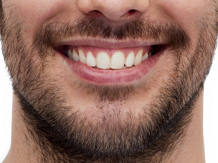 Mann mit Bart und weissen, schönen Zähnen (© Depositphotos)